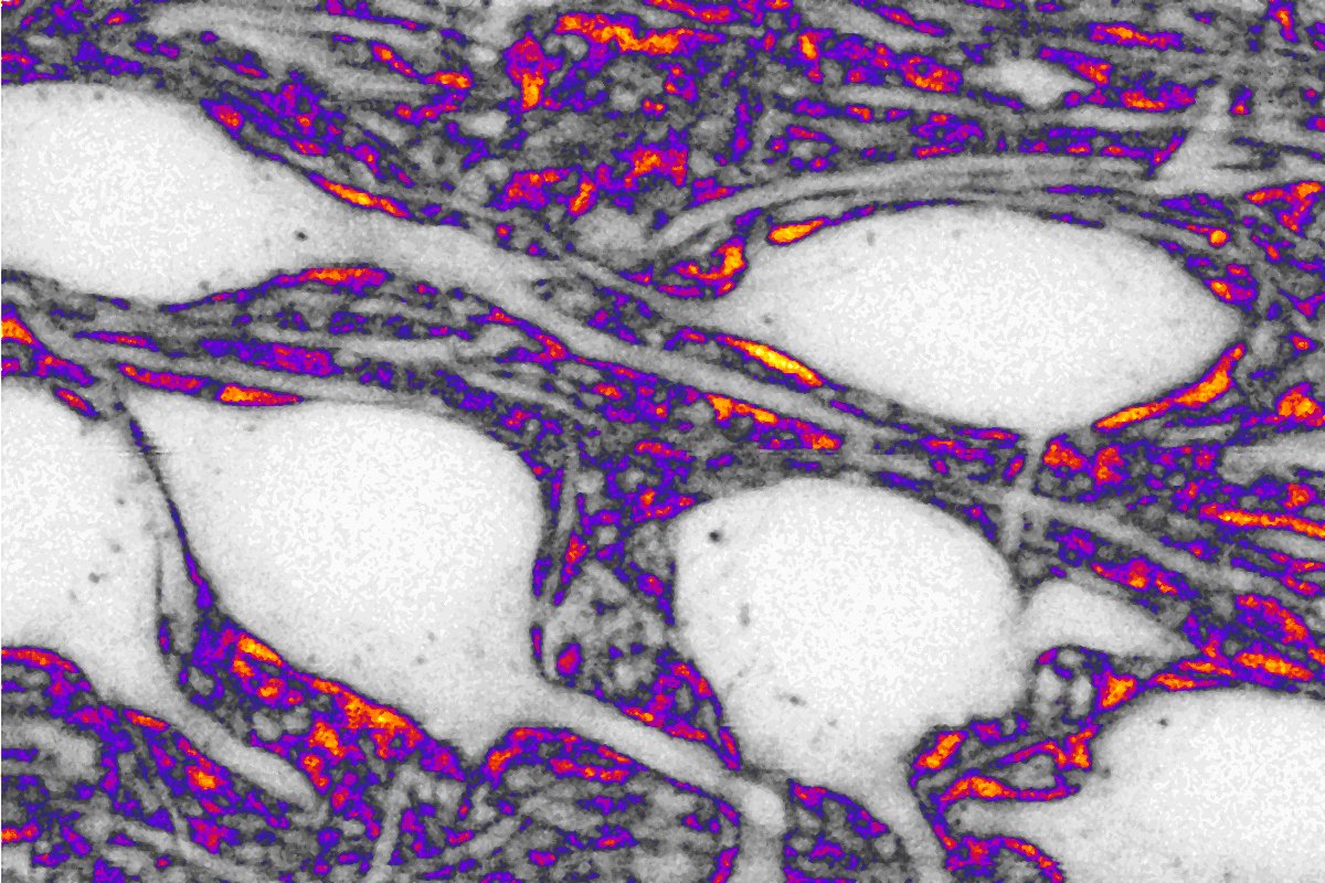 The space between neurons also “thinks”. A study reveals how its shape influences brain communication